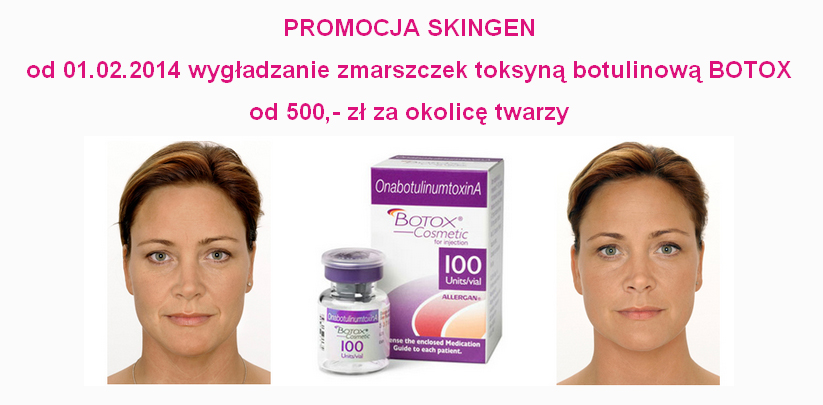 zdjecie
